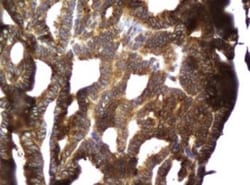 CCDC93 Antibody (OTI6E11), Novus Biologicals 0.1mL; Unlabeled:Antibodies,