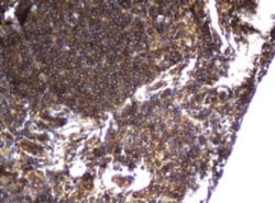 CCDC93 Antibody (OTI6E11), Novus Biologicals 0.1mL; Unlabeled:Antibodies,