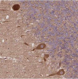 CCDC93 Antibody, Novus Biologicals:Antibodies:Primary Antibodies