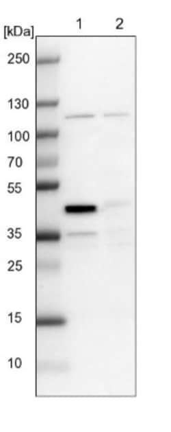 CCDC94 Antibody, Novus Biologicals 0.1mL; Unlabeled:Antibodies, Polyclonal