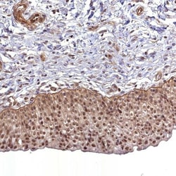 CCDC94 Antibody, Novus Biologicals 0.1mL; Unlabeled:Antibodies, Polyclonal