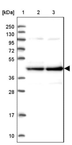 CCDC94 Antibody, Novus Biologicals 0.1mL; Unlabeled:Antibodies, Polyclonal