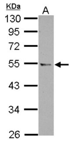 CCDC97 Antibody, Novus Biologicals 0.1mL; Unlabeled:Antibodies, Polyclonal