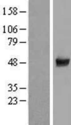 Novus Biologicals&trade;&nbsp;CCDC97 Overexpression Lysate