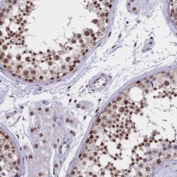 CCDC97 Antibody, Novus Biologicals:Antibodies:Primary Antibodies