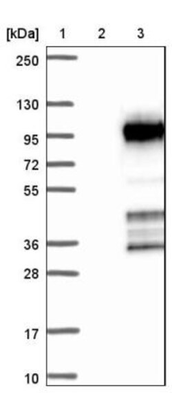 CCDC9 Antibody, Novus Biologicals 25 &mu;L; Unlabeled:Antibodies, Polyclonal