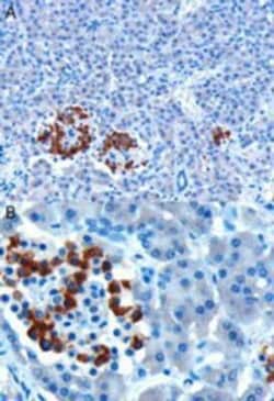 CCK-AR Antibody, Novus Biologicals 0.1mg; Unlabeled:Antibodies, Polyclonal