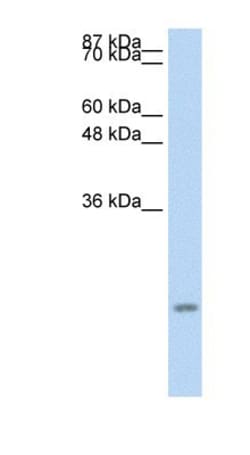 CCL13/MCP-4 Antibody, Novus Biologicals:Antibodies:Primary Antibodies
