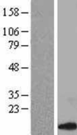 Novus Biologicals&trade;&nbsp;CCL14/HCC-1/HCC-3 Overexpression Lysate
