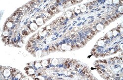 CCL18/PARC Antibody, Novus Biologicals 0.05mg; Unlabeled:Antibodies, Polyclonal