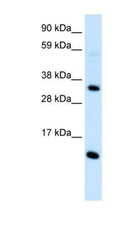 CCL18/PARC Antibody, Novus Biologicals 0.05mg; Unlabeled:Antibodies, Polyclonal