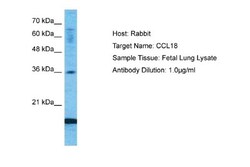CCL18/PARC Antibody, Novus Biologicals 0.05mg; Unlabeled:Antibodies, Polyclonal