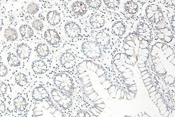 CCL25/TECK Antibody - Azide and BSA Free, Novus Biologicals 0.05mg; Unlabeled:Antibodies,
