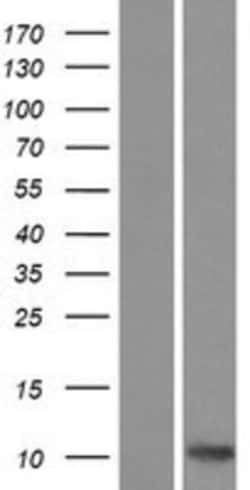 Novus Biologicals&trade;&nbsp;CCL27/CTACK Overexpression Lysate