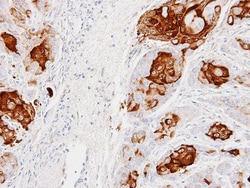 CCL28 Antibody, Novus Biologicals 0.1mL; Unlabeled:Antibodies, Polyclonal