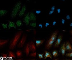 CCL2/MCP1 Antibody - BSA Free, Novus Biologicals 0.1mL; Unlabeled:Antibodies,