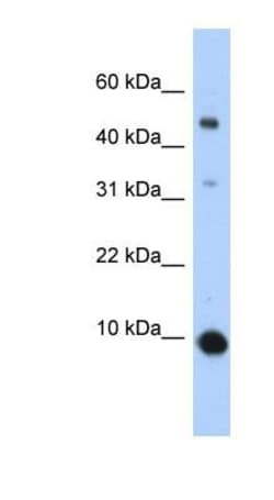 CCL2/MCP1 Antibody, Novus Biologicals 100 &mu;L | Buy Online | Novus Biologicals | Fisher Scientific