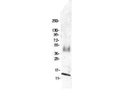 CCL4/MIP-1 beta Antibody, Novus Biologicals 0.1mg; Unlabeled:Antibodies,