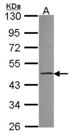 CCM2 Antibody, Novus Biologicals 0.1 mL | Buy Online | Novus Biologicals | Fisher Scientific
