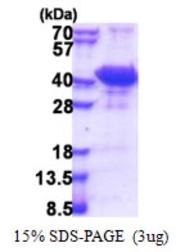 Novus Biologicals&trade;&nbsp;Recombinant Human CCM2 His Protein