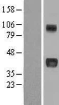 Novus Biologicals&trade;&nbsp;NOV/CCN3 Overexpression Lysate