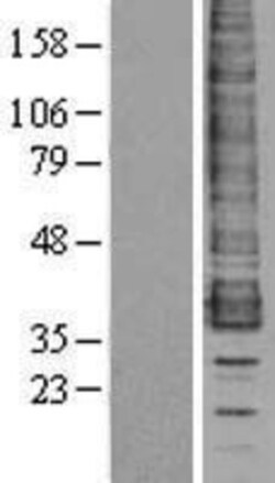 Novus Biologicals&trade;&nbsp;CCR1 Overexpression Lysate