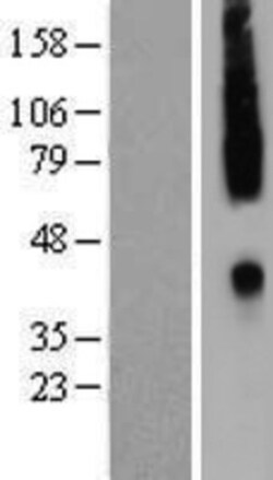Novus Biologicals&trade;&nbsp;CCR2 Overexpression Lysate