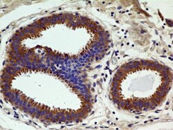 CCR2 Antibody (3G7) - BSA Free, Novus Biologicals 0.1mg; Unlabeled:Antibodies,