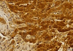 CCR2 Antibody - BSA Free, Novus Biologicals:Antibodies:Primary Antibodies