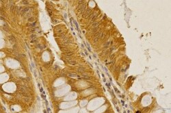 CCR2 Antibody - BSA Free, Novus Biologicals:Antibodies:Primary Antibodies
