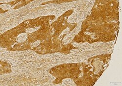 CCR2 Antibody - BSA Free, Novus Biologicals:Antibodies:Primary Antibodies