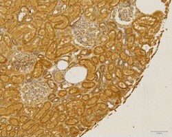 CCR2 Antibody - BSA Free, Novus Biologicals:Antibodies:Primary Antibodies