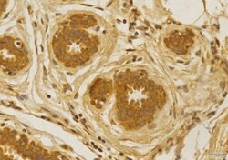 CCR2 Antibody - BSA Free, Novus Biologicals:Antibodies:Primary Antibodies