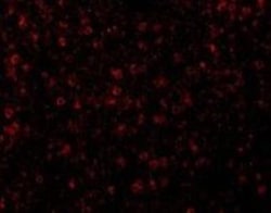 CCR3 Antibody - BSA Free, Novus Biologicals 0.025 mg, Unconjugated:Antibodies,