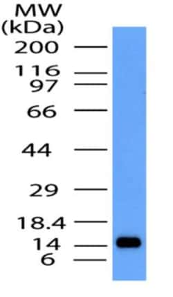 CCR5 Antibody, Novus Biologicals:Antibodies:Primary Antibodies