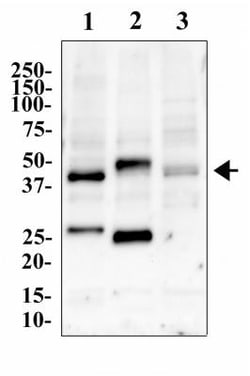 CCR5 Antibody, Novus Biologicals:Antibodies:Primary Antibodies