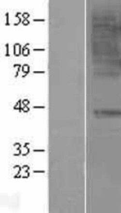 Novus Biologicals&trade;&nbsp;CCR6 Overexpression Lysate