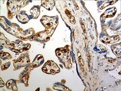 CCR6 Antibody (MM0066-3L1) - Azide and BSA Free, Novus Biologicals:Antibodies:Primary