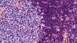 CCR6 Antibody (MM0066-3L1) - Azide and BSA Free, Novus Biologicals:Antibodies:Primary