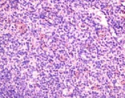 CCR6 Goat anti-Human, Mouse, Polyclonal, Novus Biologicals 0.1 mg; Unconjugated:Antibodies,