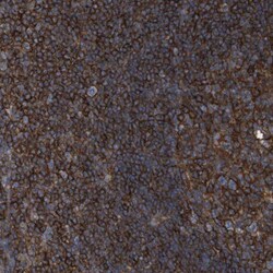 CCR6 Antibody, Novus Biologicals:Antibodies:Primary Antibodies