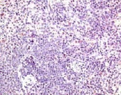CCR7 Antibody, Novus Biologicals 0.02mg; Unlabeled:Antibodies, Polyclonal