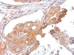 CCR8 Antibody, Novus Biologicals 0.1mL; Unlabeled:Antibodies, Polyclonal