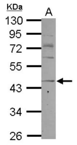 CCR8 Antibody, Novus Biologicals 0.1mL; Unlabeled:Antibodies, Polyclonal