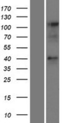 Novus Biologicals&trade;&nbsp;CCRL2/CRAM-A/B Overexpression Lysate