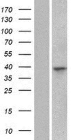 Novus Biologicals&trade;&nbsp;CCSMST1 Overexpression Lysate