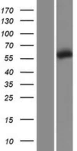 Novus Biologicals&trade;&nbsp;CCT5 Overexpression Lysate