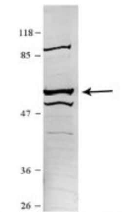 CCT5 Antibody, Novus Biologicals 100 &mu;L | Buy Online | Novus Biologicals | Fisher Scientific