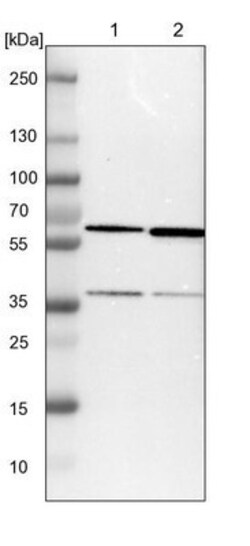 CCT5 Antibody, Novus Biologicals 25 &mu;L; Unlabeled:Antibodies, Polyclonal