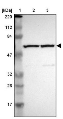 CCT5 Antibody, Novus Biologicals 25 &mu;L; Unlabeled:Antibodies, Polyclonal